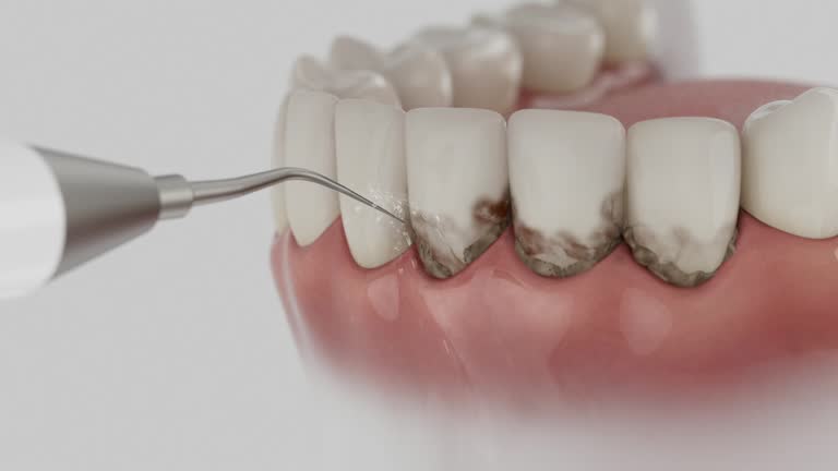 Trusted Tooth Extraction service in St. James, MN - Dentist Open Now